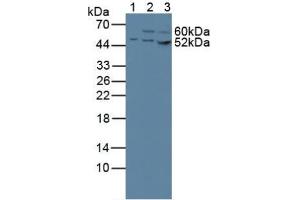 Western blot analysis of (1) Human 293T Cells, (2) Human HeLa cells and (3) Human HepG2 Cells. (CS anticorps  (AA 103-394))