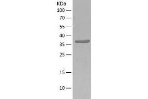 Western Blotting (WB) image for Cold Inducible RNA Binding Protein (CIRBP) (AA 1-172) protein (His-IF2DI Tag) (ABIN7122437)