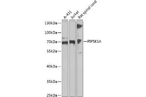Western blot analysis of extracts of various cell lines, using PIP5K1A antibody  at 1:1000 dilution. (PIP5K1A anticorps  (AA 231-500))