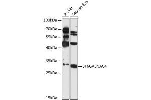 Western blot analysis of extracts of various cell lines, using ST6G antibody (ABIN6131358, ABIN6148539, ABIN6148540 and ABIN6216674) at 1:3000 dilution. (ST6GALNAC4 anticorps  (AA 120-210))
