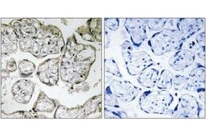 Immunohistochemistry analysis of paraffin-embedded human placenta tissue, using ME2 Antibody. (NAD-ME anticorps  (AA 201-250))