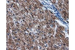 Immunohistochemical staining of paraffin-embedded liver tissue using anti-FAHD2Amouse monoclonal antibody. (FAHD2A anticorps)
