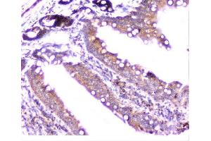IHC analysis of cortactin using anti-cortactin antibody (ABIN6719306). (Cortactin anticorps  (AA 1-105))