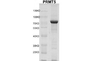 Recombinant PRMT5 protein gel.