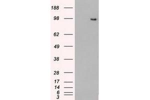 Image no. 14 for anti-TYRO3 Protein Tyrosine Kinase (TYRO3) antibody (ABIN1501606)