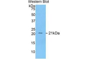 Western blot analysis of the recombinant protein. (FGA anticorps  (AA 77-244))