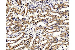 Immunohistochemistry analysis of paraffin-embedded mouse kidney using NFKBIB Polyclonal Antibody at dilution of 1:300.