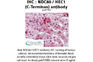 Image no. 1 for anti-NDC80 Kinetochore Complex Component Homolog (NDC80) (C-Term) antibody (ABIN1737233) (NDC80 anticorps  (C-Term))