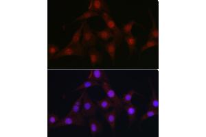 Immunofluorescence analysis of NIH/3T3 cells using C9orf72 Rabbit pAb (ABIN7266391) at dilution of 1:100 (40x lens). (C9ORF72 anticorps  (AA 1-230))
