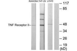 Western blot analysis of extracts from RAW264.