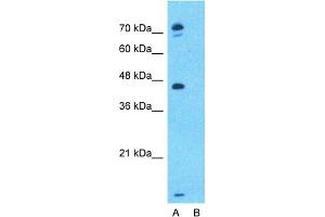 Host:  Rabbit  Target Name:  EPX  Sample Type:  MCF7  Lane A:  Primary Antibody  Lane B:  Primary Antibody + Blocking Peptide  Primary Antibody Concentration:  1ug/ml  Peptide Concentration:  5ug/ml  Lysate Quantity:  25ug/lane/lane  Gel Concentration:  0. (EPX anticorps  (Middle Region))