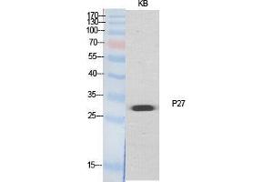 Western Blot (WB) analysis of specific cells using p27 Polyclonal Antibody.