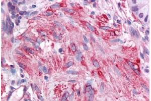 Human Small Intestine, Muscularis Mucosa: Formalin-Fixed, Paraffin-Embedded (FFPE)