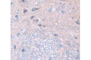 IHC-P analysis of Human Tissue, with DAB staining. (FBLN3 anticorps  (AA 258-493))