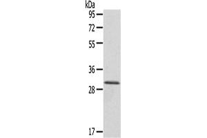 Western Blotting (WB) image for anti-HIV-1 Tat Interactive Protein 2, 30kDa (HTATIP2) antibody (ABIN5956861) (HIV-1 Tat Interactive Protein 2, 30kDa (HTATIP2) anticorps)