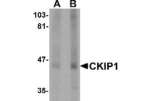 Western blot analysis of CKIP1 in human lung tissue lysate with CKIP1 antibody at (A) 1 and (B) 2 µg/mL. (PLEKHO1 anticorps  (C-Term))