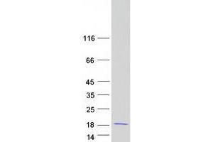 Validation with Western Blot