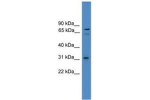 Image no. 1 for anti-Zinc Finger Protein 691 (ZNF691) (N-Term) antibody (ABIN6745260) (ZNF691 anticorps  (N-Term))