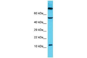 Host: Rabbit Target Name: C9orf16 Sample Type: HCT15 Whole Cell lysates Antibody Dilution: 1. (C9orf16 anticorps  (Middle Region))
