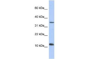 WB Suggested Anti-NXNL2 Antibody Titration: 0. (NXNL2 anticorps  (Middle Region))