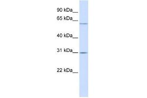 TMEM106C antibody used at 1 ug/ml to detect target protein.