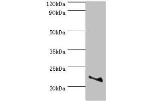 Western blot All lanes: ASF1A antibody at 2 μg/mL + Jurkat whole cell lysate Secondary Goat polyclonal to rabbit IgG at 1/10000 dilution Predicted band size: 23 kDa Observed band size: 23 kDa (ASF1A anticorps  (AA 1-204))