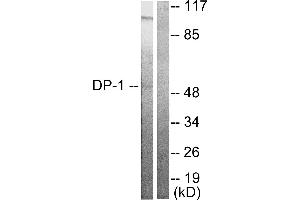 Western blot analysis of extracts from HeLa cells, using DP-1 antibody.