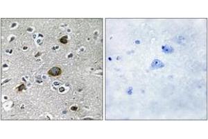 Immunohistochemistry analysis of paraffin-embedded human brain tissue, using AKAP1 Antibody.
