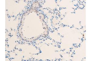 ABIN6267272 at 1/100 staining mouse lung tissue sections by IHC-P.