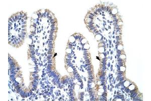 EXOSC10 antibody was used for immunohistochemistry at a concentration of 4-8 ug/ml to stain Epithelial cells of intestinal villus (arrows) in Human Intestine. (EXOSC10 anticorps  (C-Term))