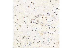 Immunohistochemistry of paraffin embedded mouse spinal cord using USP27 (ABIN7076113) at dilution of 1:700 (400x lens) (USP27X anticorps)