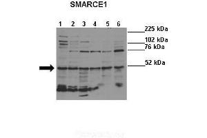 Lanes :  Lane 1: HeLa (human)Lane 2: NHEM (human)Lane 3: Melba (mouse)Lane 4: NIH3T3 (mouse)Lane 5: S16 (rat)Lane 6: H9C2 (rat)   Primary Antibody Dilution :   1:500    Secondary Antibody :  Donkey anti-rabbit-HRP   Secondary Antibody Dilution :   1:5000   Gene Name :  SMARCE1   Submitted by :  Ivana de la Serna, University of Toledo