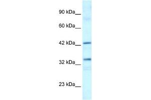WB Suggested Anti-TAF1A Antibody Titration:  0. (TAF1A anticorps  (C-Term))
