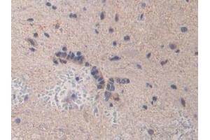 Detection of BMP15 in Rat Spinal cord Tissue using Polyclonal Antibody to Bone Morphogenetic Protein 15 (BMP15)