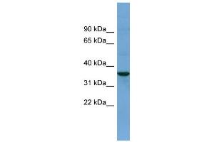 WB Suggested Anti-BACE2 Antibody Titration:  0. (BACE2 anticorps  (N-Term))