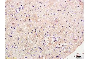 Formalin-fixed and paraffin embedded rat brain labeled with Anti phospho-PI3K p85/PIK3R1(Tyr368) Polyclonal Antibody, Unconjugated (ABIN711041) at 1:200 followed by conjugation to the secondary antibody and DAB staining (PIK3R1 anticorps  (pTyr368))