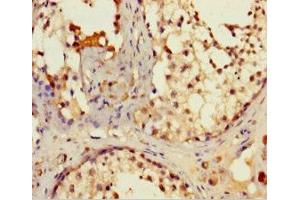 Immunohistochemistry of paraffin-embedded human testis tissue using ABIN7157004 at dilution of 1:100 (IFT80 anticorps  (AA 1-268))