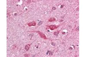 Immunohistochemistry (IHC) image for anti-Toll-Like Receptor 8 (TLR8) (AA 750-850) antibody (ABIN2470503) (TLR8 anticorps  (AA 750-850))
