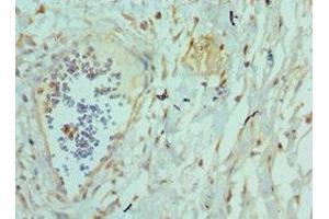 Immunohistochemistry of paraffin-embedded human epityphlon tissue using ABIN7173794 at dilution of 1:100