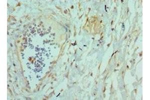 Immunohistochemistry of paraffin-embedded human epityphlon tissue using ABIN7173794 at dilution of 1:100 (TWEAK anticorps  (AA 42-123))