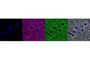 Immunohistochemistry (IHC) image for anti-ATP Synthase, H+ Transporting, Mitochondrial F1 Complex, alpha Subunit 1, Cardiac Muscle (ATP5A1) antibody (ABIN7456080)