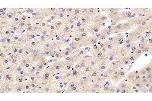 Detection of HIF1a in Human Liver Tissue using Monoclonal Antibody to Hypoxia Inducible Factor 1 Alpha (HIF1a)