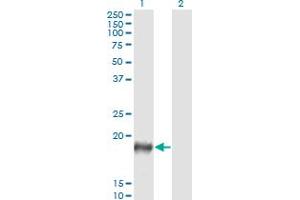 Western Blot analysis of PSCA expression in transfected 293T cell line by PSCA monoclonal antibody (M03), clone 5C2.