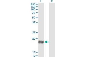 Western Blot analysis of PSCA expression in transfected 293T cell line by PSCA monoclonal antibody (M03), clone 5C2. (PSCA anticorps  (AA 23-95))