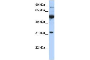 WB Suggested Anti-EIF2B1 Antibody Titration: 0.