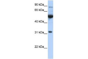 WB Suggested Anti-EIF2B1 Antibody Titration: 0. (EIF2B1 anticorps  (C-Term))
