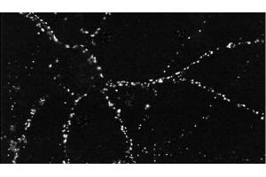 Immunocytochemistry/Immunofluorescence analysis using Mouse Anti-PSD95 Monoclonal Antibody, Clone 6G6 . (DLG4 anticorps  (Atto 488))
