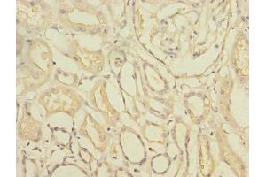 Immunohistochemistry of paraffin-embedded human kidney tissue using ABIN7171935 at dilution of 1:100 (TTC33 anticorps  (AA 1-262))