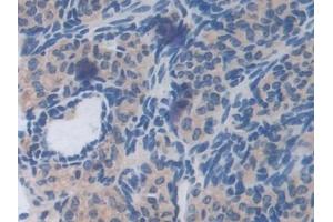 Detection of HPSE in Mouse Ovary Tissue using Polyclonal Antibody to Heparanase (HPSE)