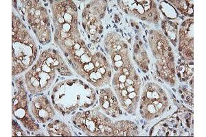 Image no. 2 for anti-Mitogen-Activated Protein Kinase Kinase 1 (MAP2K1) antibody (ABIN1499388) (MEK1 anticorps)